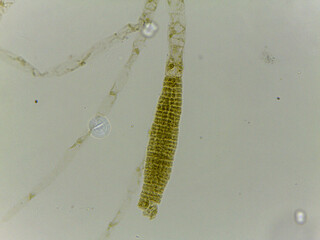 Microscopic Examination of Ectocarpus Filamentous Brown Algae and Specialized Reproductive Structu © Mohammed