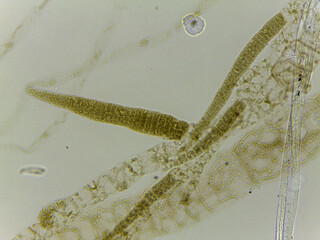 Microscopic Examination of Ectocarpus Filamentous Brown Algae and Specialized Reproductive Structu © Mohammed