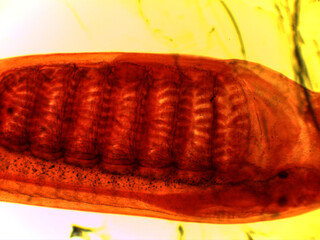 Microscopic Anatomy of Ammocoetes Larva and Dogfish Shark Placoid Sc © Mohammed