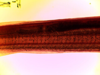 Microscopic Anatomy of Ammocoetes Larva and Dogfish Shark Placoid Sc © Mohammed