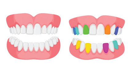 Colorful cartoon illustration depicting upper and lower sets of human teeth