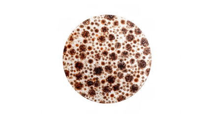 Close up of a freckled face, emphasizing natural beauty and unique characteristics, with a transparent background that enhances the focus on skincare and dermatology