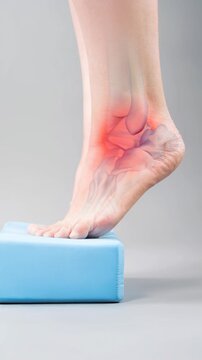 Joint diseases and inflammation, plantar fasciitis, heel spur, foot pain, individual balance training on a blue block, demonstrating foot position and stability