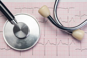 Stethoscope on electrocardiogram chart showing heart rhythm analysis