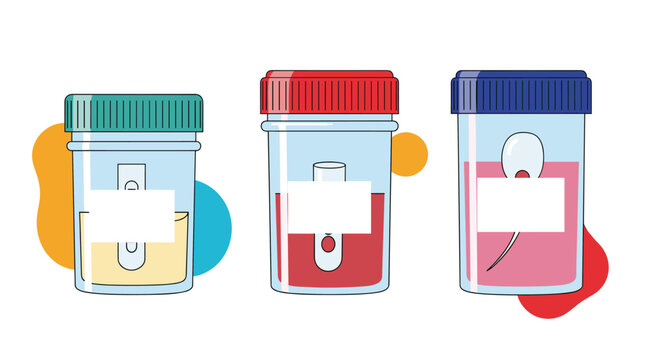 Collection of medical analysis sample containers with urine blood and semen for laboratory testing and health diagnosis purposes.