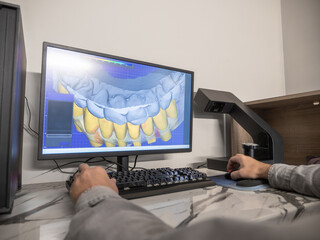 Dental technician using CAD software to design digital 3D model of patient teeth for prosthetic restoration.