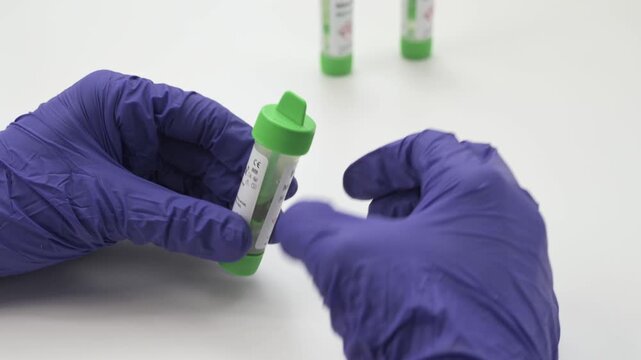 Gloved hands putting a stool sample into a test tube and mixing it on a white background