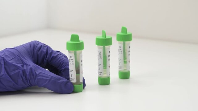 Medical professional in blue gloves handling stool sample collection kits on a white background