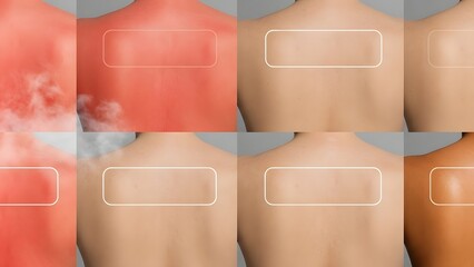 Diverse Skin Tones and Conditions Closeup.