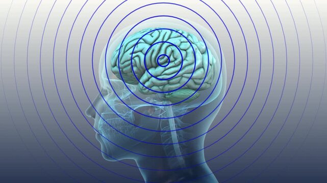 Concussion Effect On Human Brain Activity