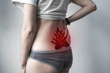 Rear view of a person with black kinesiology tape applied in a fan pattern to their lower back, holding their side in discomfort with a red glow highlighting the area of pain.