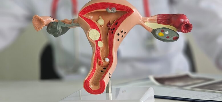 Anatomical model of the female reproductive system and ultrasound image