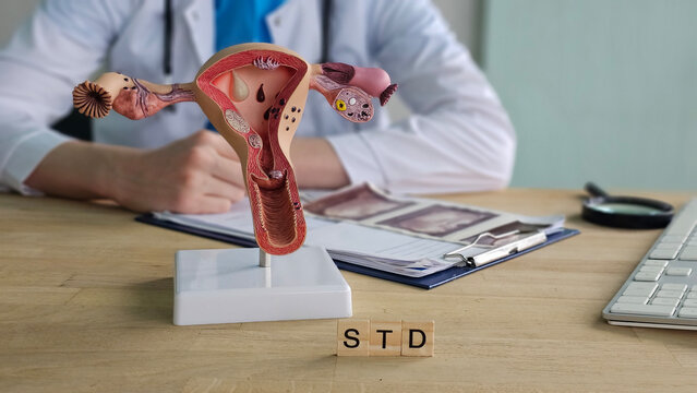 A gynecologist shows signs of STD. Sexually transmitted diseases caused by parasites in women concept