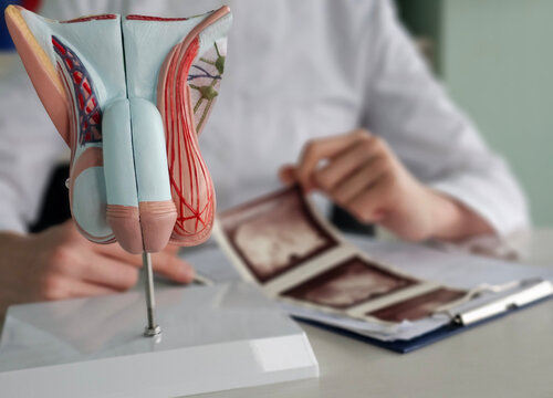 Prostate diseases and treatment, including ultrasound