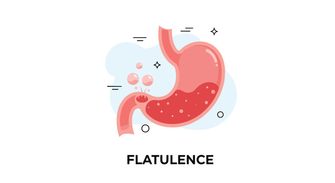 Medical vector illustration of the human stomach showing the process of flatulence with gas bubbles, indicating digestive problems or bloating.