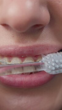 Close Up. Oral hygiene for braces. Teen girl cleaning and brushing teeth with clear ceramic braces using special brushing tools. Slow motion.