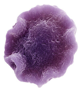 Irregular, flattened disk-shaped halophile archaea with purple coloration.