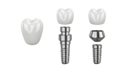 Detailed Dental Implant System Components Product Shot with Crown, Abutment, and Post