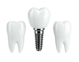 3D rendered image of dental implant and two teeth on a black background