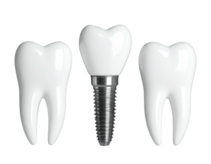 Three pristine white teeth, one a dental implant, on black. Realistic medical dental concept