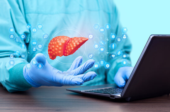 A hepatologist reviews liver cirrhosis data on a laptop. Concept of liver diagnosis, liver damage assessment, and modern digital liver health. Liver with fibrotic and damaged tissue.