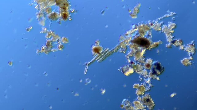 Diatoms and other microorganisms under the microscope at 100x Magnification