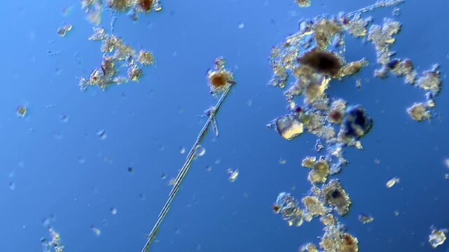 Diatoms and other microorganisms under the microscope at 100x Magnification