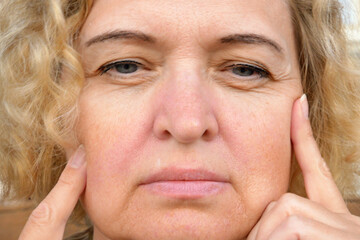 A middle-aged woman examines the expression lines on her face