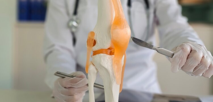 Knee arthroscopy and knee surgery. Doctor holds scalpel and model of knee joint and meniscus concept