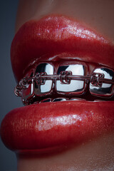 Extreme close-up of smiling mouth with peace symbol grills on canine teeth