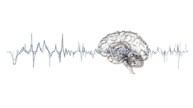 Realistic illustration of a human brain displaying seizure activity, highlighted by a red electroencephalogram - eeg - line, isolated on a transparent background for medical use