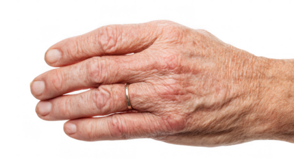 Open wrinkled hand of an elderly woman with age spots, liver spots, and visible veins isolated on transparent background, showcasing the effects of aging on skin