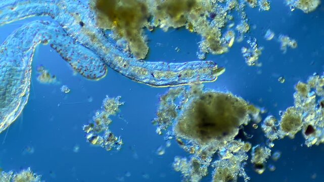 Annelid Aeolosoma under the microscope at 100x Magnification