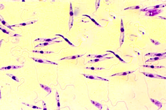 Promastigote of lishmania spp under microscope.