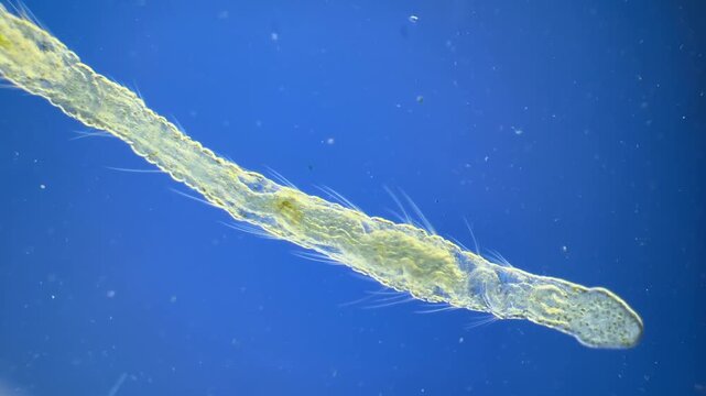 Annelid Aeolosoma under the microscope at 40x Magnification