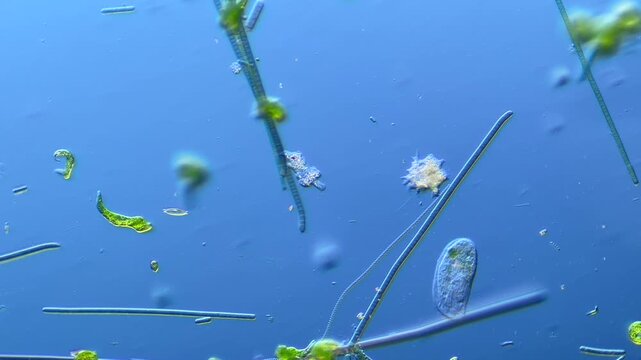 Microorganism Amoeba under the microscope at 100x Magnification
