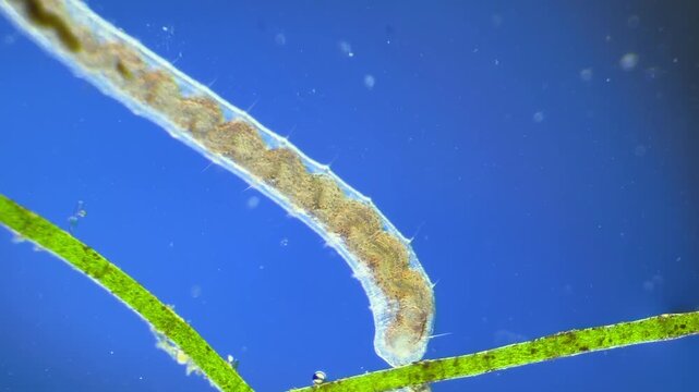 Worms under the microscope