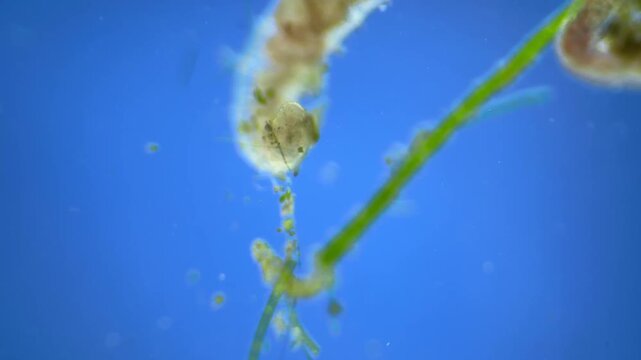 Worms under the microscope