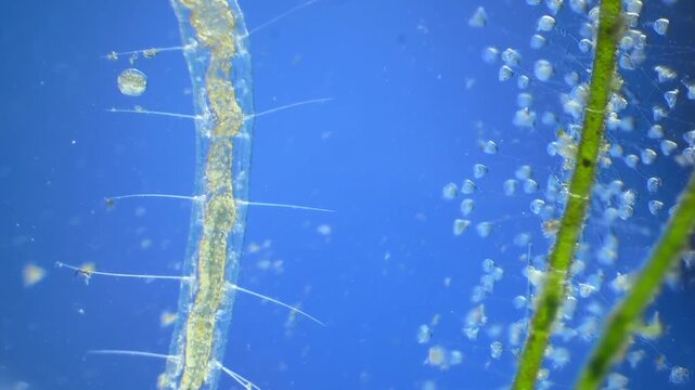 Worms under the microscope