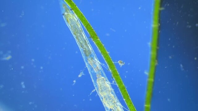 Worms under the microscope