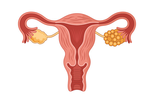 Illustration of female reproductive system with ovaries and uterus