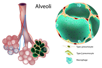 Detailed medical illustration of human pulmonary alveoli showing alveolar sacs, capillary network, pneumocytes, alveolar macrophages. Human lung alveoli cross section