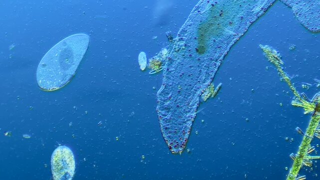 Single-celled ciliates and other microorganisms under the microscope at 100x Magnification