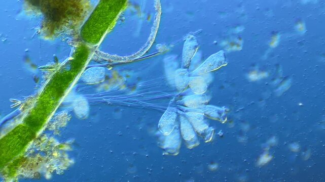 Single-celled ciliates and other microorganisms under the microscope at 100x Magnification