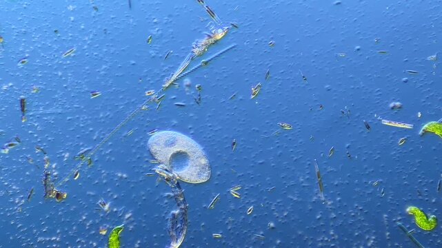 Single-celled ciliates and other microorganisms under the microscope at 100x Magnification