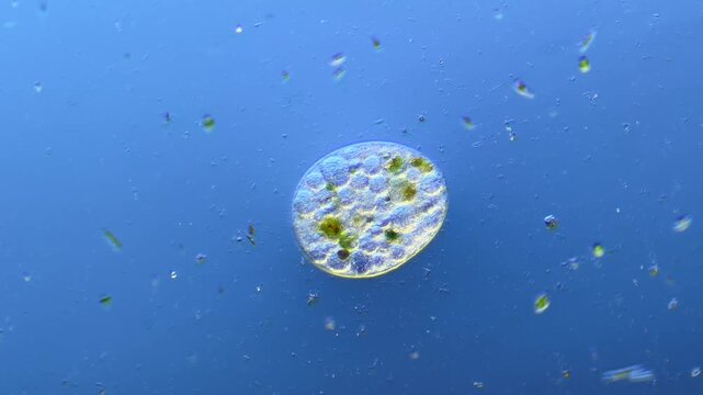 Single-celled ciliates and other microorganisms under the microscope at 100x Magnification