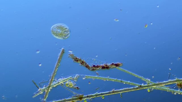 Single-celled ciliates and other microorganisms under the microscope at 100x Magnification