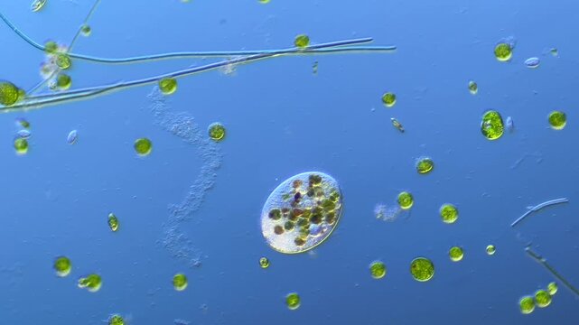Single-celled ciliates and other microorganisms under the microscope at 100x Magnification