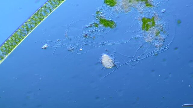 Single-celled ciliates and other microorganisms under the microscope at 100x Magnification