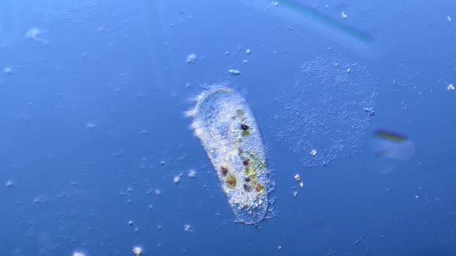 Protists Ciliates  under the microscope at 100x Magnification